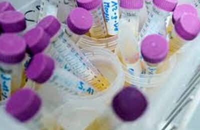 Benzen, substanță cancerigenă, găsită în creme de protecție solară