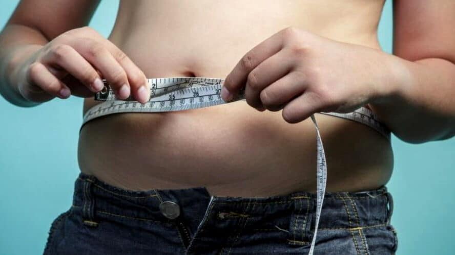 obezitate românia tratament