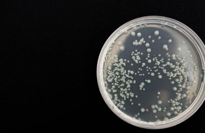 Bacterie intestinală crește forța musculară la vârstnici cu 29%