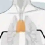 Timusul, organul care reduce cu 50% riscul de deces