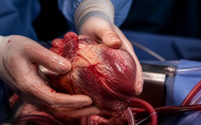 Primul transplant de inimă realizat la Institutul de Boli Cardiovasculare din Iași a salvat un pacient de 44 de ani
