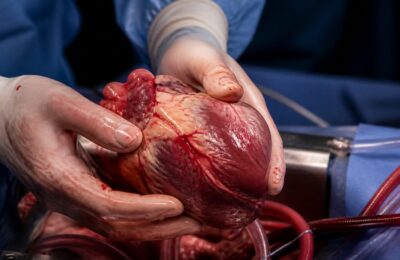 Primul transplant de inimă realizat la Institutul de Boli Cardiovasculare din Iași a salvat un pacient de 44 de ani