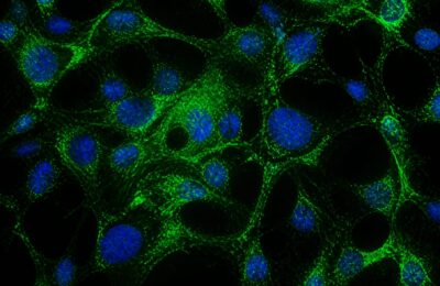 Terapia cu nanoparticule a prelungit cu 50% supraviețuirea la șoarecii cu glioblastom