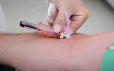 Un nou test de sânge cu șapte proteine poate stabili mai exact stadiul bolii Alzheimer