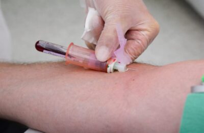 Un nou test de sânge cu șapte proteine poate stabili mai exact stadiul bolii Alzheimer