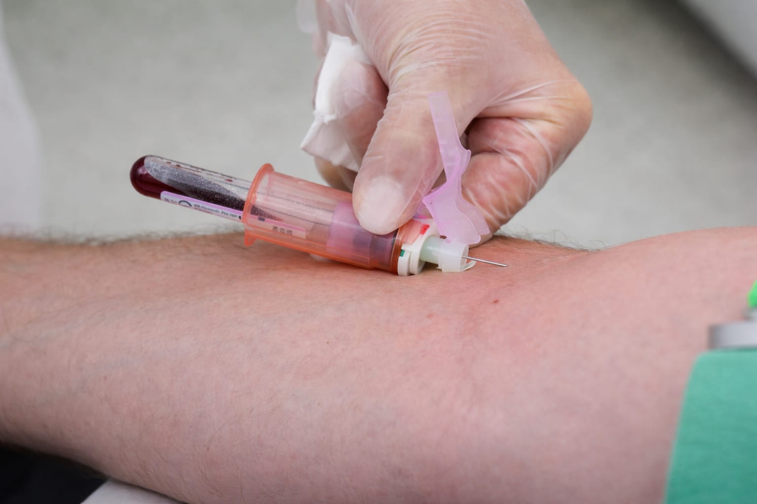 Un nou test de sânge cu șapte proteine poate stabili mai exact stadiul bolii Alzheimer